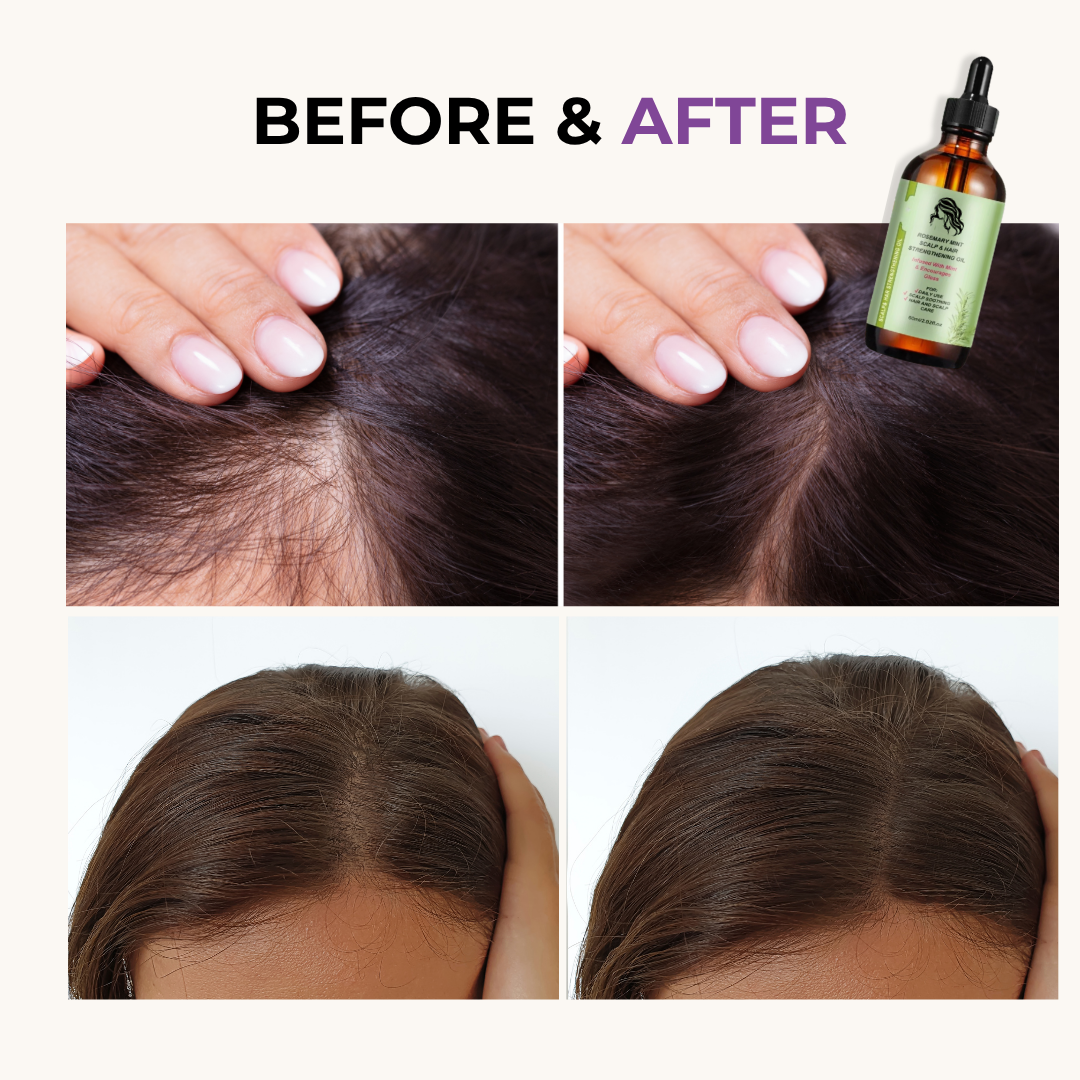 Healira Rosemary Hair Oil